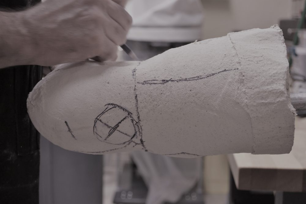 How Your Custom Prosthesis or Orthosis is Made